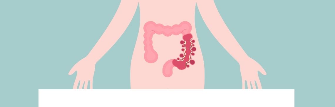 Image of IBS-D